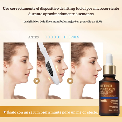 Masajeador Facial EMS V-Shape